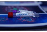 Ученые создали тест, определяющий, нужен ли бустер от COVID