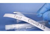 Starting December 24, the Ministry for Healthcare will again publish a weekly list of red zone countries at high risk for the spread of coronavirus. 