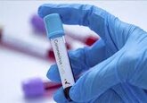 De la începutul anului 2021, în Moldova au fost confirmate peste 1.000 de cazuri noi de COVID-19. 