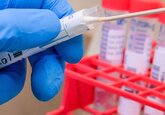 În Moldova, 7.241 de persoane sunt în prezent bolnave de coronavirus.
