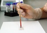 Ученые выяснили, сколько максимально может прожить человек