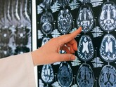 Persoanele optimiste au modele similare de activitate cerebrală. Cum stau lucrurile în cazul pesimiștilor