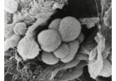 Inteligența artificială ar putea fi folosită în depistarea precoce a cancerului