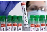 Разработана первая в мире тест-система для выявления оспы обезьян