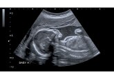 Pollution can reach babies in the womb and could damage developing organs, scientists say