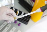 Ученые обнаружили сезонность в распространении коронавируса