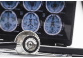 Experții americani recomandă aprobarea unui nou tratament împotriva bolii Alzheimer / Cum funcționează Donanemab