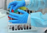Опровергнута связь между группой крови и риском заражения коронавирусом