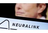 Elon Musk&#039;s brain chip company Neuralink says it has won FDA approval for human trials