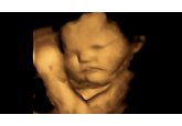 Babies in the womb &#039;smile for carrots and cry at greens&#039;, study suggests