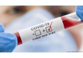 În Moldova, începând cu 22 ianuarie, este instituit în toată țara nivel de pericol &quot;roșu&quot; pentru răspândirea COVID-19, fiind introduse noi restricții.