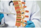 Найден простой способ определить риск развития остеопороза по фотографии