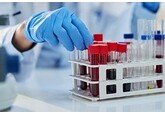 Раскрыт предсказывающий инфаркт точнее холестерина анализ