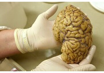 Ученым впервые удалось «оживить» мозг после глубокой заморозки