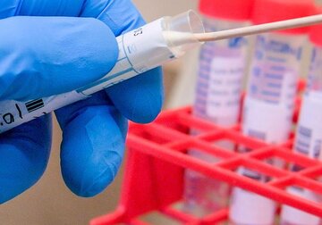 În Moldova, 7.241 de persoane sunt în prezent bolnave de coronavirus.