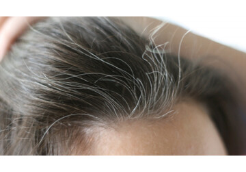 Părul alb, un semn de sănătate. Boala gravă la care persoanele cărunte sunt mai puțin expuse