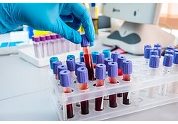 Врач призвал после 40 лет регулярно контролировать три показателя