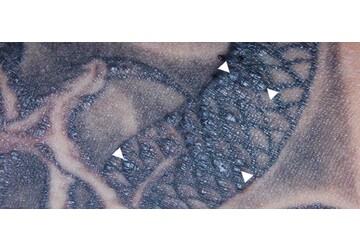 Татуировки влияют на работу иммунной системы, подтвердили ученые