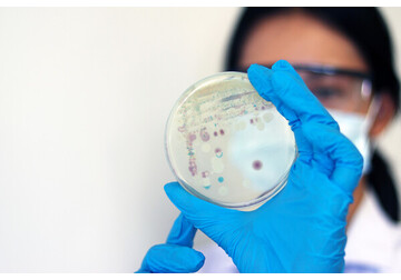 Ученые выяснили, какой грибок переживет путешествие на Марс