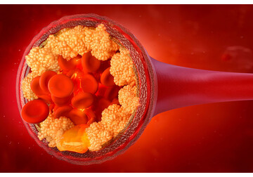 Открыт главный регулятор уровня холестерина в организме