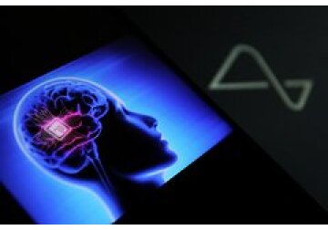 Перечислены плюсы и минусы жизни с мозговым имплантом